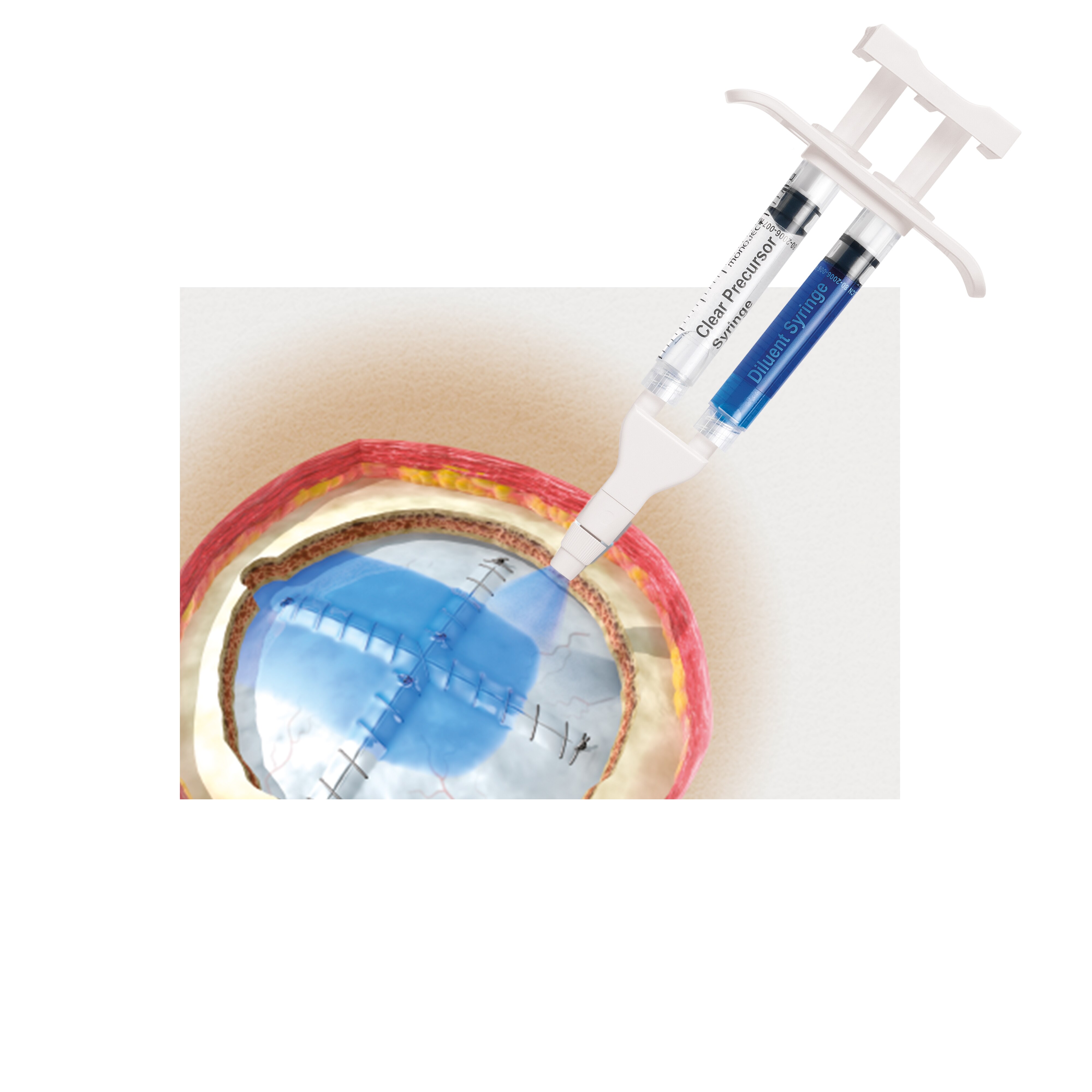 DuraSeal Dural Sealant Product Image