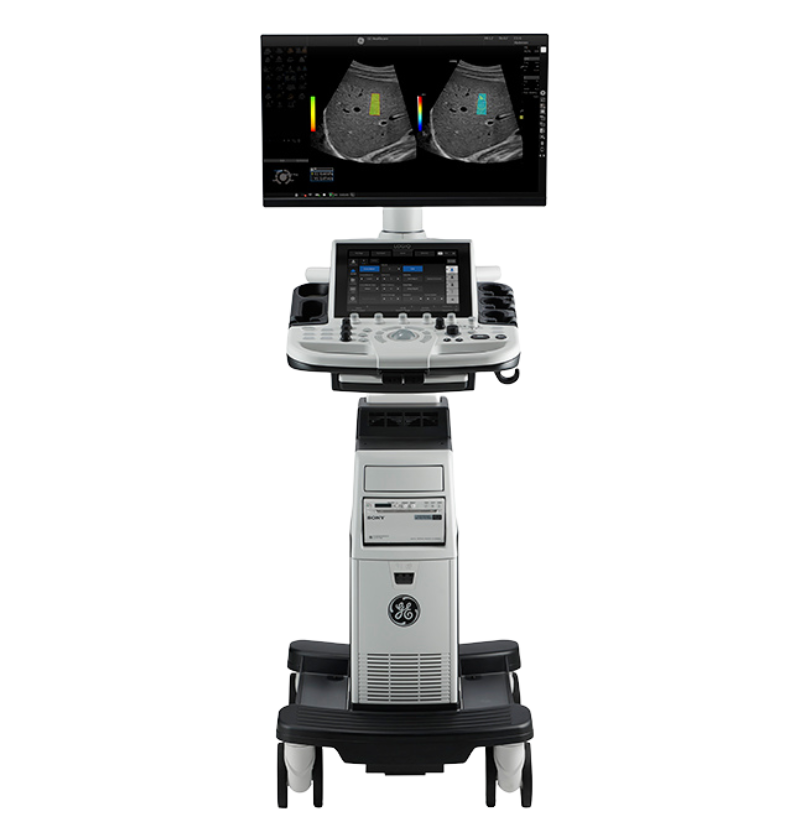 LOGIQ P10 Ultrasound System